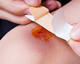 ¿Cómo prevenir y tratar las heridas?